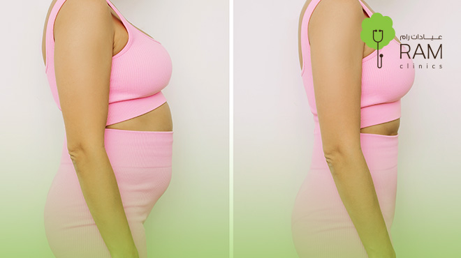 اسعار-عملية-نحت-الجسم