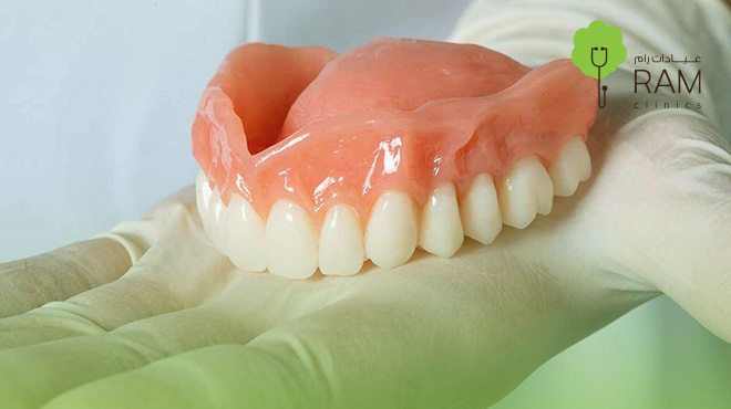 تلبيسة-أسنان-مؤقتة
