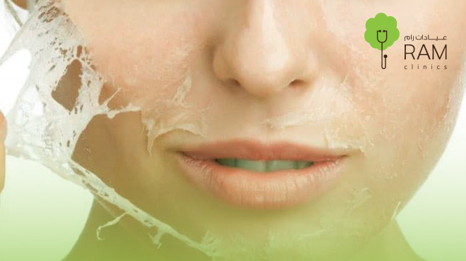 فوائد-مقشر-أحماض-الفواكه فوائد-مقشر-أحماض-الفواكه