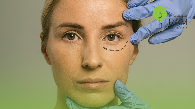 جلسة-رتوش-بعد-الفيلر جلسة-رتوش-بعد-الفيلر