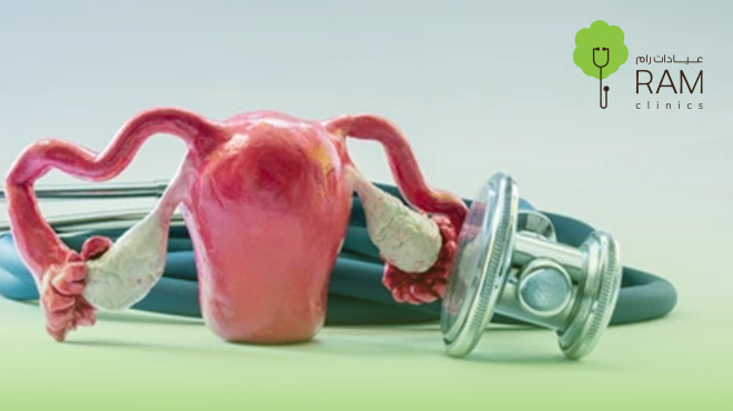 علاج-بطانة-الرحم-المهاجرة