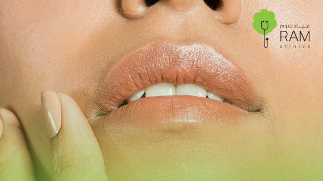 توريد-الشفايف 