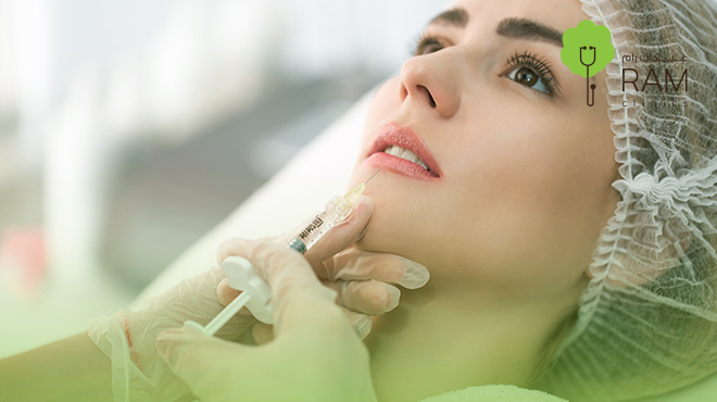 مناطق-حقن-الفيلر