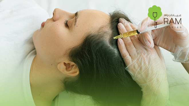 حقن-الخلايا-الجذعية-للشعر