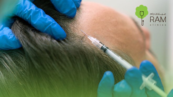سعر-حقن-الخلايا-الجذعية-للشعر