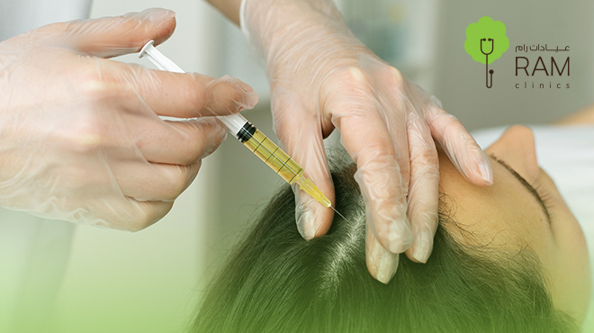 أضرار-حقن-الخلايا-الجذعية-للشعر