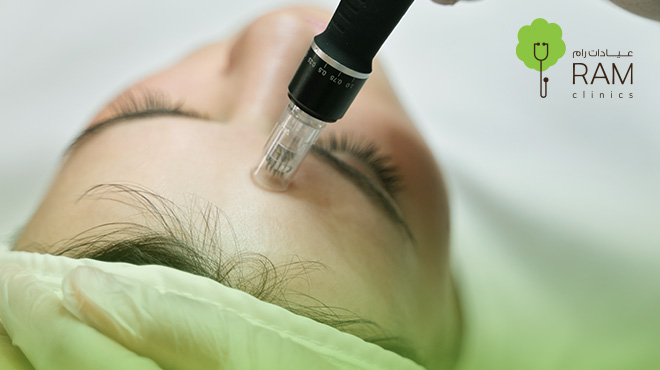 ديرما-بن-للوجه ديرما-بن-للوجه