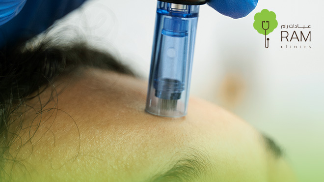 ديرما-بن-للوجه ديرما-بن-للوجه