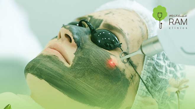 نضارة-البشرة-بالليزر-قبل-وبعد