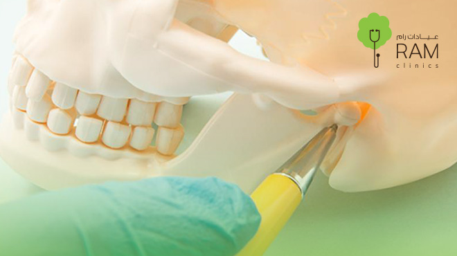 طريقة-زراعة-عظم-الفك