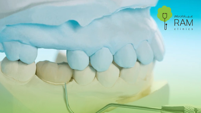 زراعة-عظم-الفك-قبل-وبعد