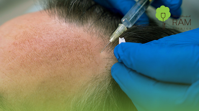 الفرق-بين-الخلايا-الجذعية-والبلازما-للشعر