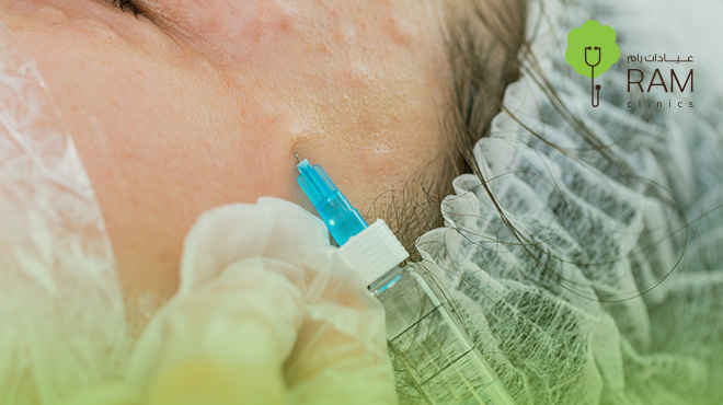 انواع-حقن-الميزوثيرابي-للوجه