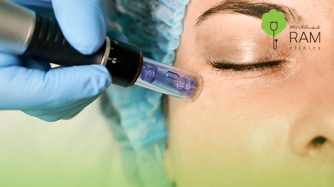 متى-تظهر-نتيجة-حقن-الميزوثيرابي-للوجه