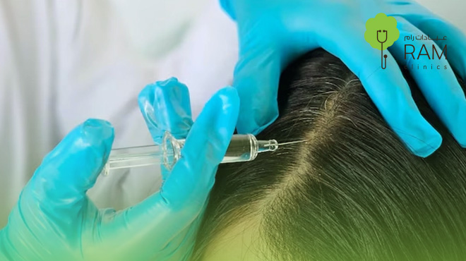 ابرة-ماجلان-للشعر