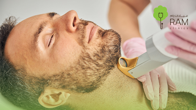 تحديد-الذقن-بالليزر