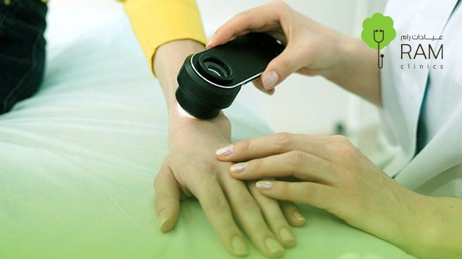 طفح-جلدي-عند-الاطفال       