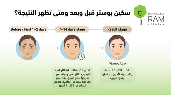 صورة-توضح-سكين-بوستر-قبل-وبعد