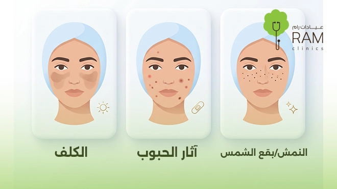 صورة-توضح-انواع-التصبغات-الجلدية