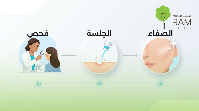 صورة-توضح-إزالة-التصبغات-الجلدية-بالليزر