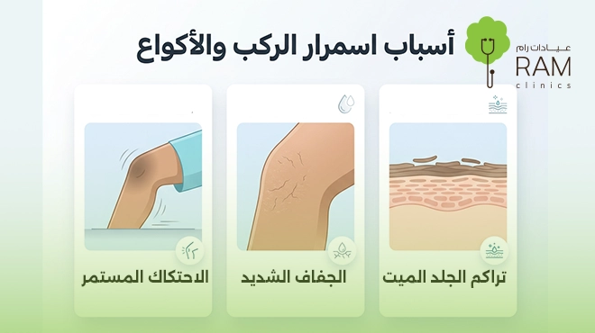 صورة-توضح-أسباب-اسمرار-الركب