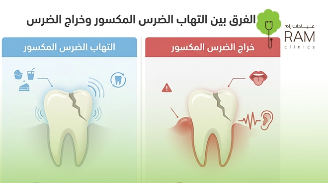 الفرق-بين-التهاب-الضرس-المكسور-وخراج-الضرس-المكسور