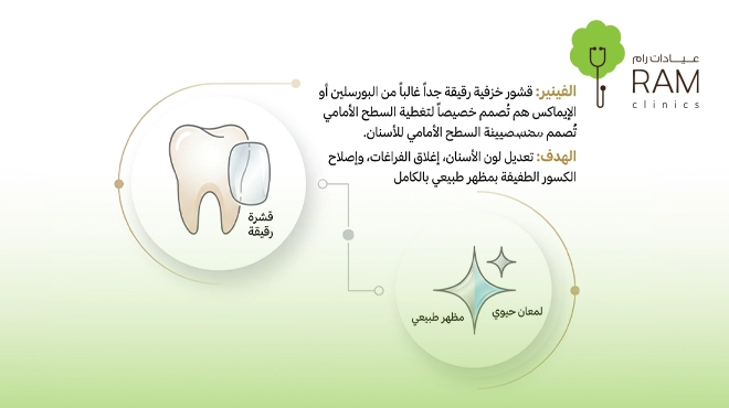 صورة-توضح-ما-هي-عدسات-فينير-الاسنان
