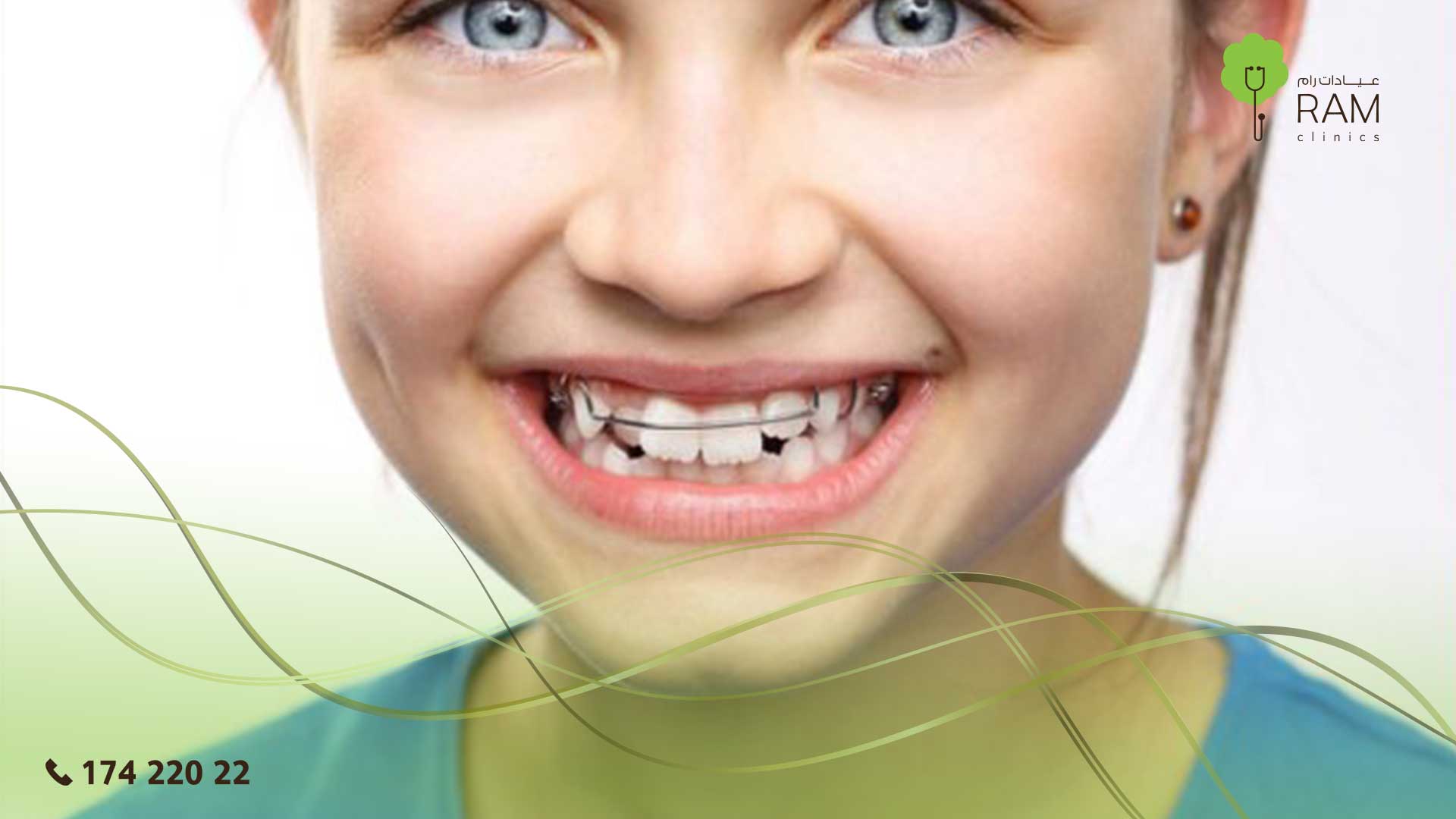 تقويم الأسنان عند الأطفال