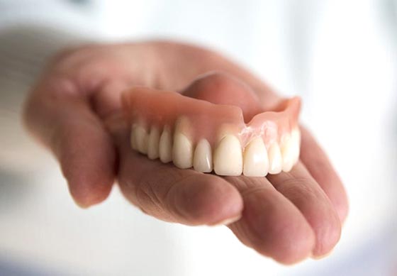 ما هي تركيبات الأسنان المؤقتة