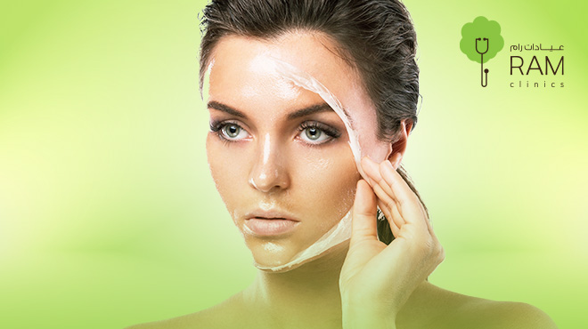 التقشير-الكيميائي