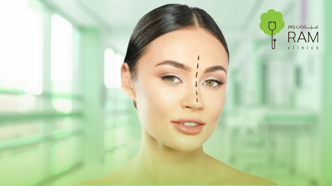 عملية-تجميل-الانف-اللحمي