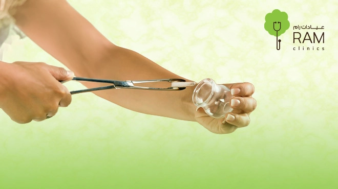 افضل-مركز-حجامة
