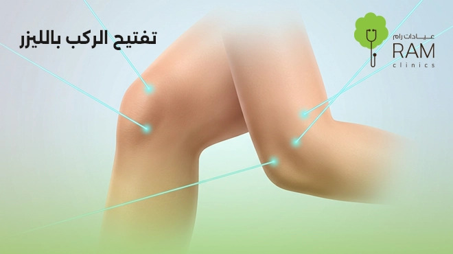 تفتيح-الركب-بالليزر