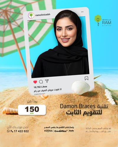 تقنية DAMON BRACES للتقويم الثابت