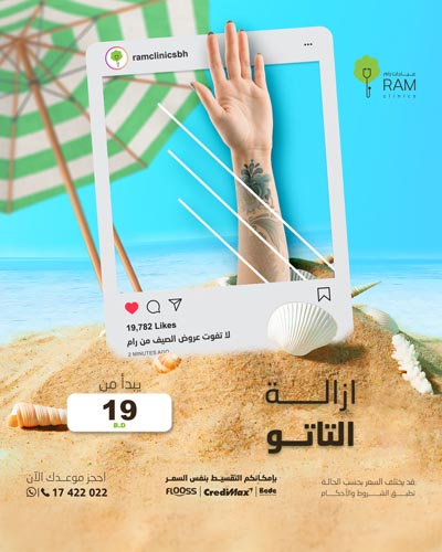 ازالة التاتو