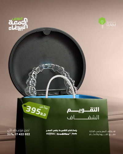 التقويم الشفاف