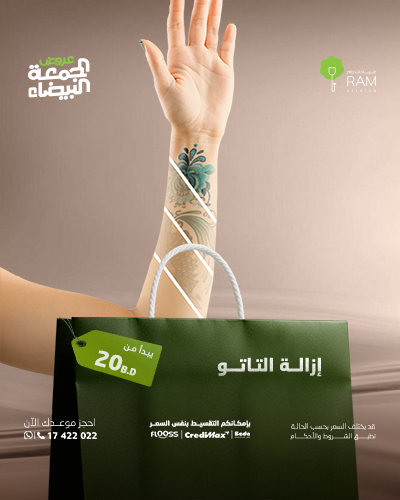 ازالة التاتو